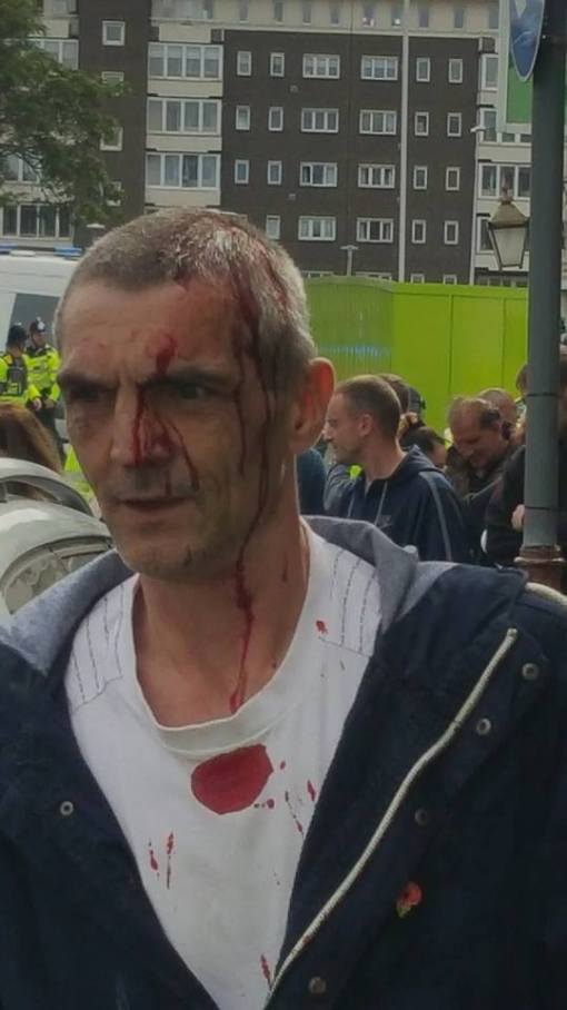 An injured fascist after clashes with the AFN